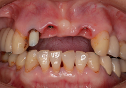 術前口腔写真